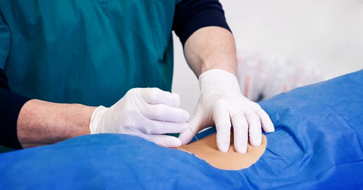 Deep Infiltrating Endometriosis