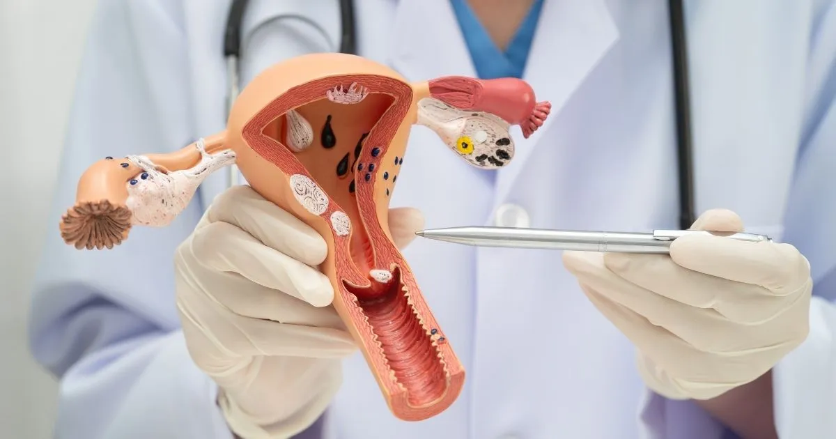 Gynecological Cancers